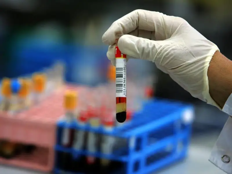 Когда стоит сдавать тест на антитела к коронавирусу