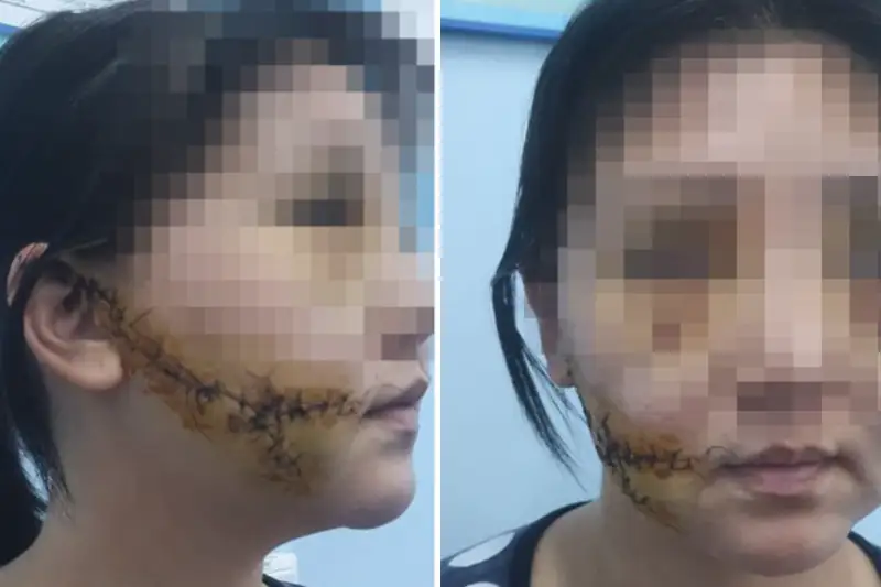 Мужчина изрезал лицо бывшей жене в Актобе: вынесен приговор