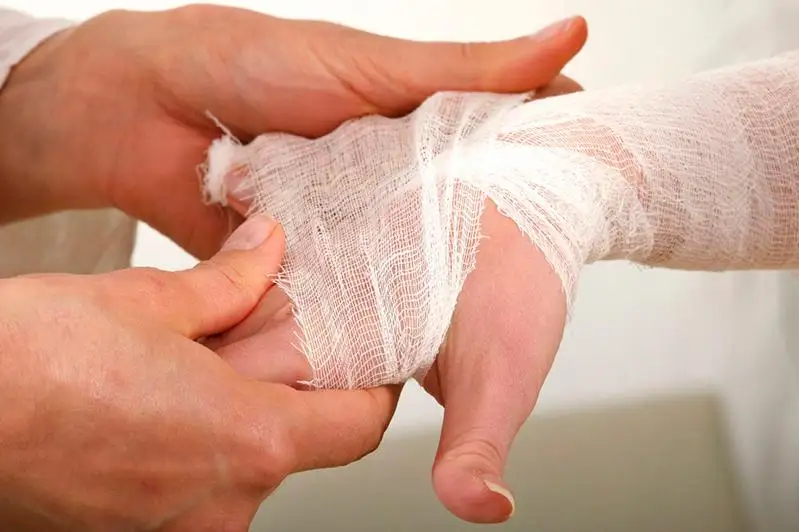 Женщина с ребенком получили ожоги при пожаре в Степногорске