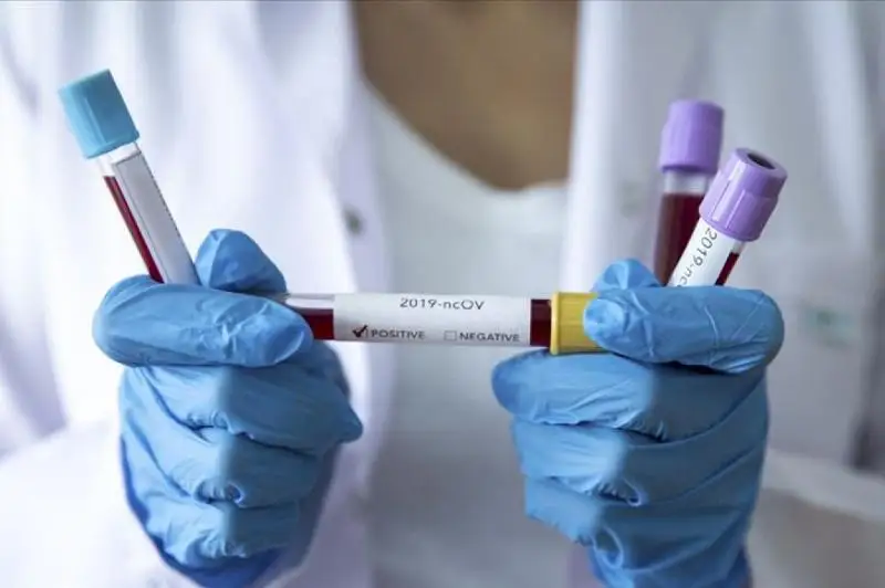 В США испытания вакцины от нового коронавируса начнутся через шесть недель