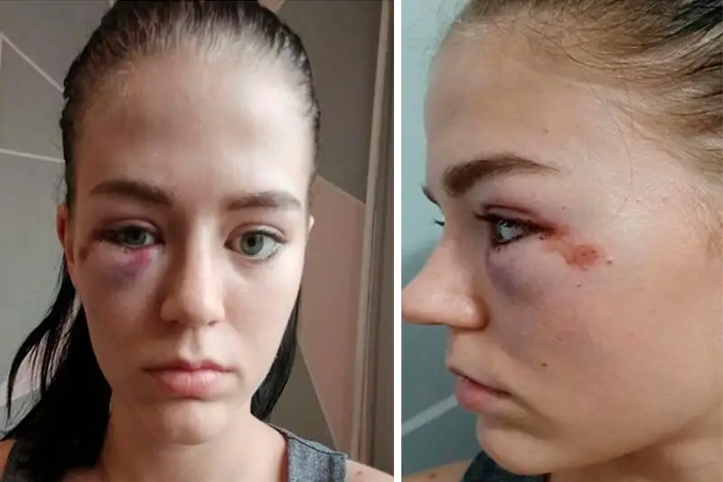 Неизвестный мужчина избил двух девушек в центре Алматы: его задержали