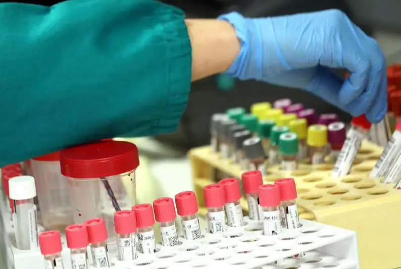 Италия на третьем месте в мире по числу заразившихся коронавирусом после Китая и Южной Кореи