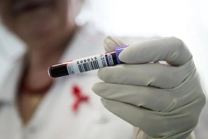 Рост распространения ВИЧ в Казахстане наблюдается среди людей старше 50 лет