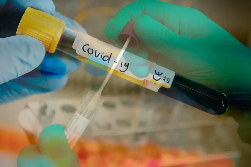 О новых случаях коронавируса рассказали в Алматинской области