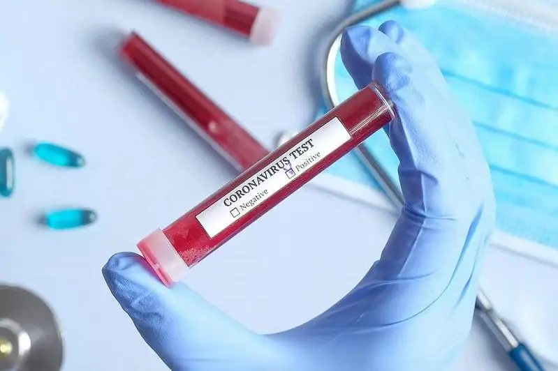 Экспресс-тесты  на определение коронавируса планируют завезти в Карагандинскую область