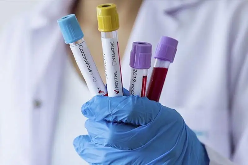 В Павлодарской области зарегистрирован ещё 21 случай коронавируса