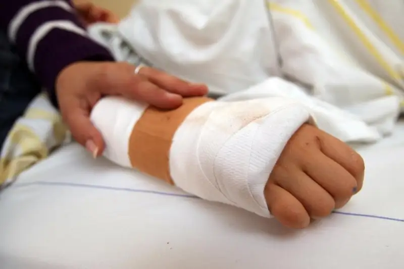 Ожоги от взрыва газовоздушной смеси получил 11-летний мальчик в Таразе