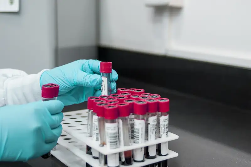 Ограничения на массовые мероприятия ввели в Москве из-за коронавируса