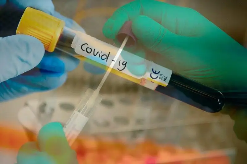 Коронавирус выявлен у сотрудника на одном из объектов NCOC