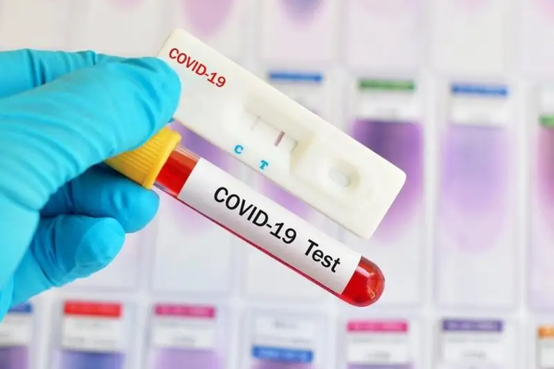 В Кыргызстане количество заболевших коронавирусом возросло до 14