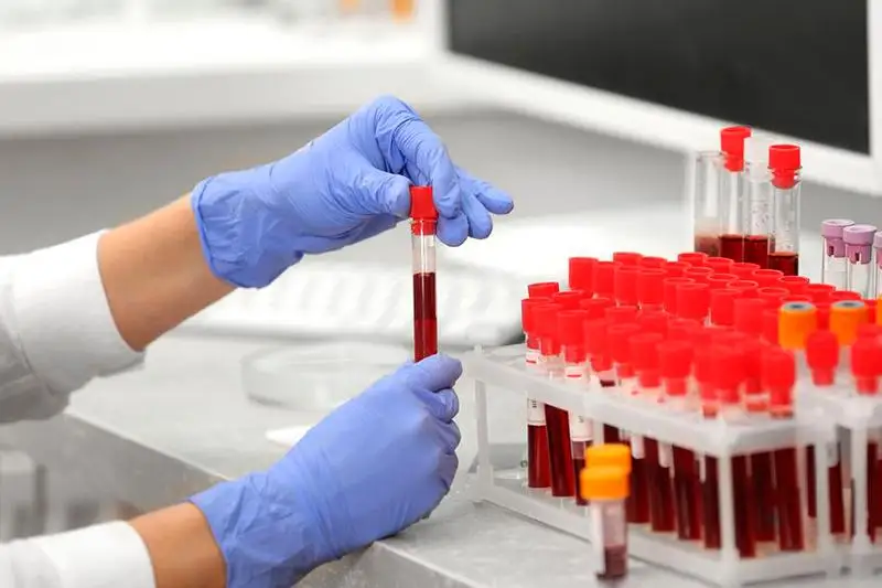 Коронавирус: анализы девушки из СКО перепроверят в Алматы