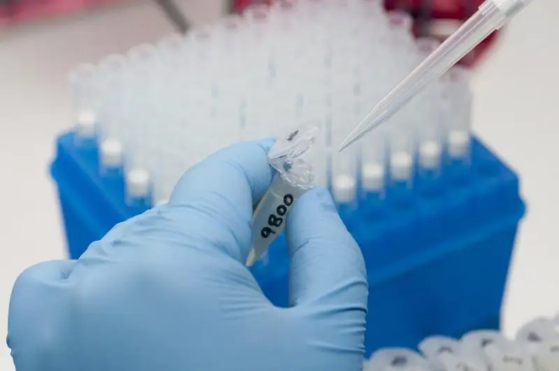 Однодневный прирост заболеваемости коронавирусом снизился в Туркестанской области