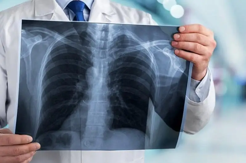 Пневмония с признаками коронавируса: 9 заболевших, 2 летальных исхода за сутки