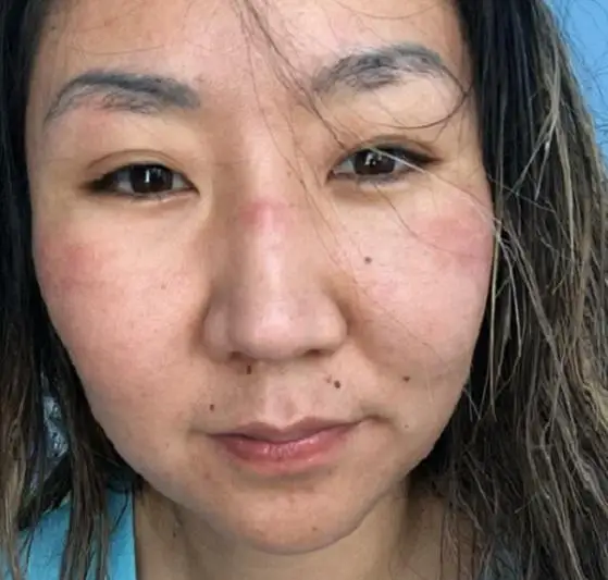 На наших лицах вмятины и царапины от средств защиты - медики Семея о буднях в «красной зоне»