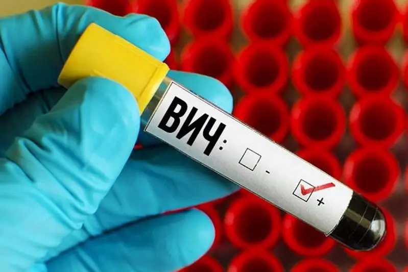 Что приводит к распространению ВИЧ-инфекции среди населения