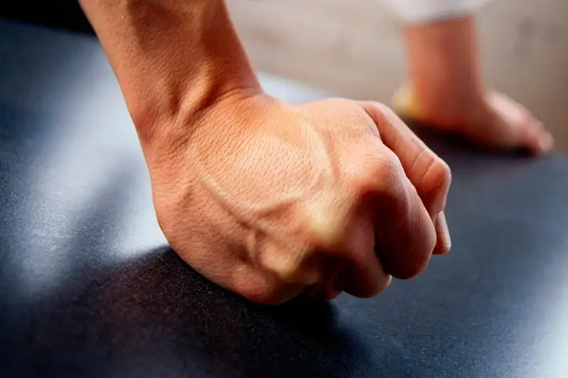 Студента с редким генетическим заболеванием избили в общежитии вуза в Алматы