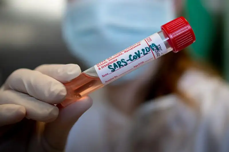 В Украине подтвержден 41 случай коронавируса, жертвами COVID-19 стали три человека