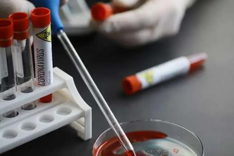 Где можно сделать тест на коронавирус в Алматы