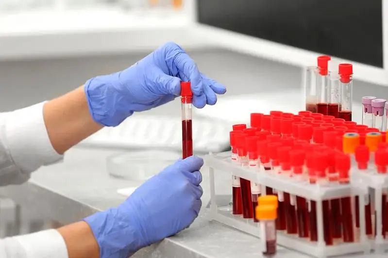 Новый подход к статистике позволит делать правильные прогнозы заболеваемости - Минздрав