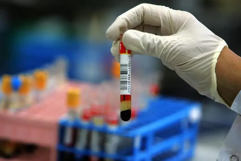 О двух новых случаях заболевания в Атырауской области