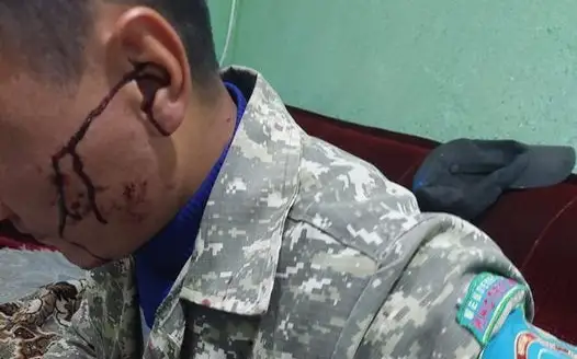 Лесника жестоко избили в Иле-Алатауском нацпарке