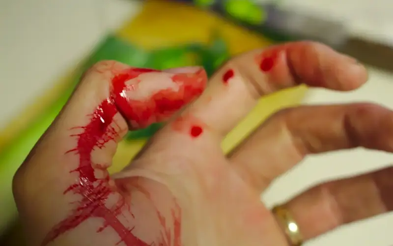 Мужчина изрезал ножом девушку в Талдыкоргане: его задержали