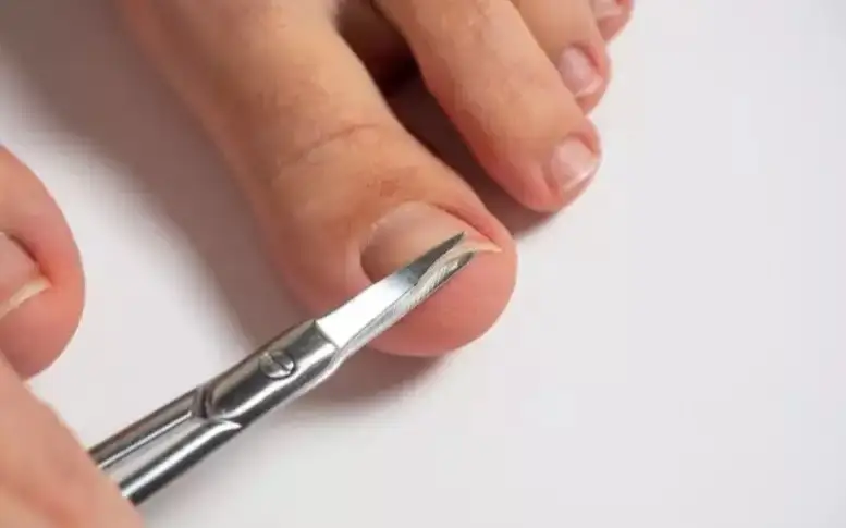 تۇندە نەگە تىرناق الۋعا بولمايدى. ەتنوگراف ءتۇسىندىردى