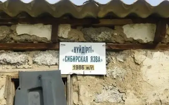 сибирская язва