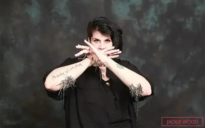 Танасига 52 та чип ўрнатган аёл Гиннес рекордлар китобига киритилди