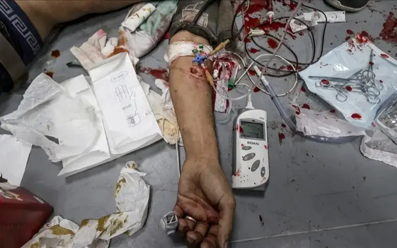 Ғазо сектори Соғлиқни сақлаш вазирлиги: кун давомида 700 киши ҳалок бўлди