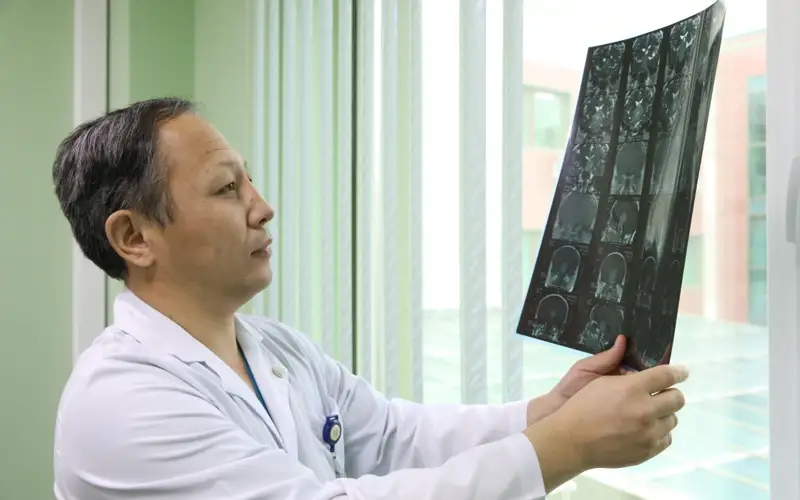 Repeated head impacts cause early neuron loss, inflammation in young athletes: study