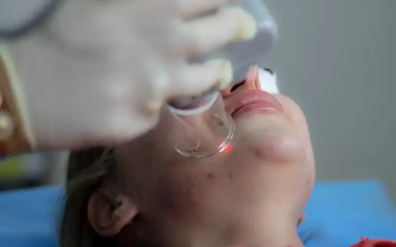 Еуропалық ғалымдар адамның терісін безеуден қорғайтын бактерия ойлап тапты