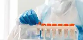 WHO, virus 