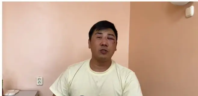 Избитый в Караганде водитель «неотложки» 