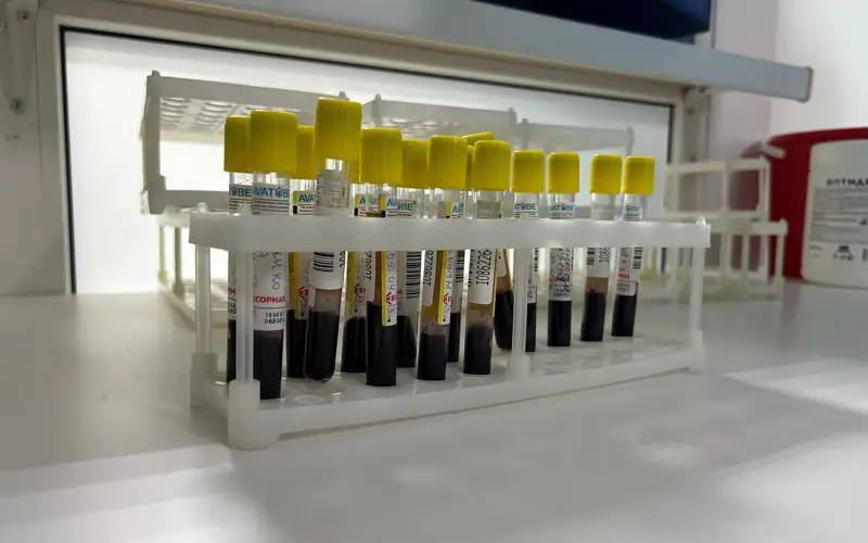 лаборатория, СПИД, ВИЧ