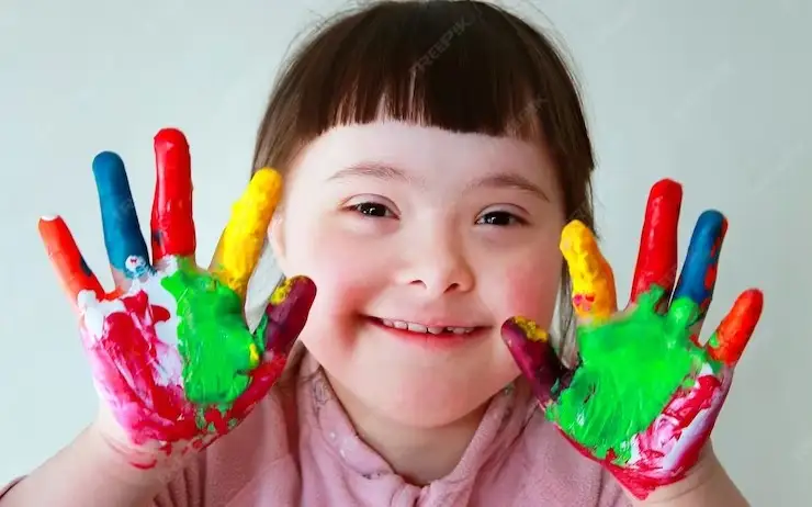 Три тысячи особенных детей нуждаются в комплексной реабилитации в ЗКО 