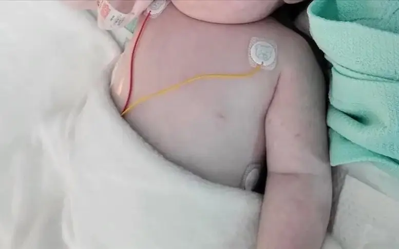 Врачам в Газе удалось спасти младенца из утробы погибшей матери