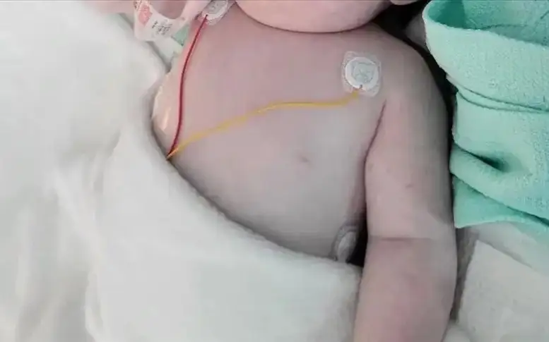 Газада дәрігерлер қайтыс болған ананың құрсағындағы сәбиді аман алып қалды