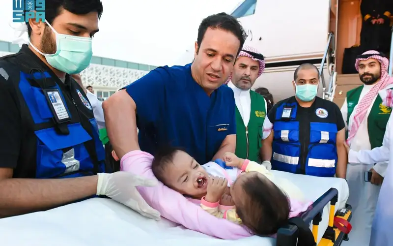 Filipino conjoined twins arrive in Riyadh for potential separation procedure