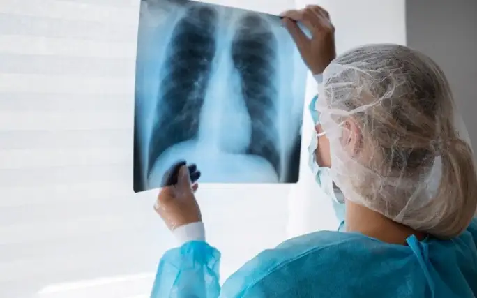 Здравоохранение, здоровье, больница, болезнь, пневмония, рентген, врачи