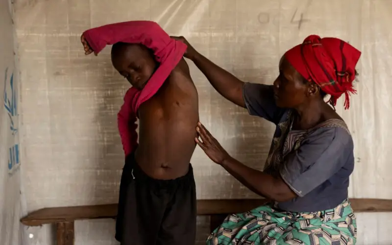 маймыл шешегі  