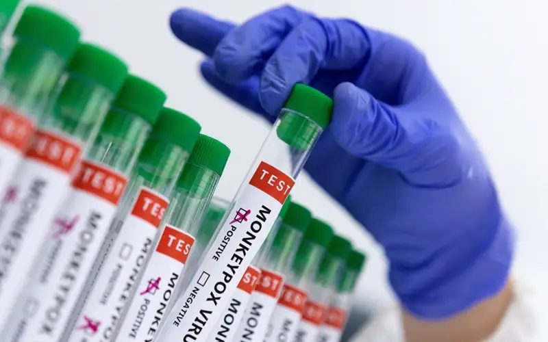 оспа обезьян, пцр 