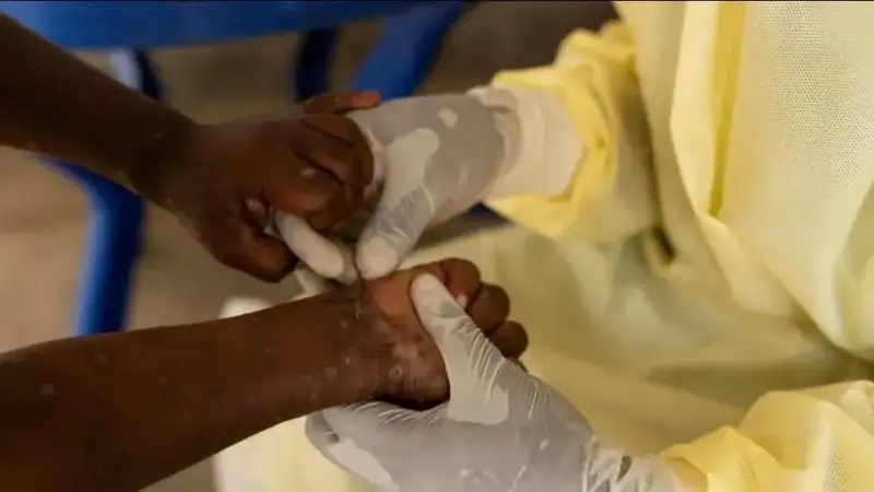 Маймун чечаги