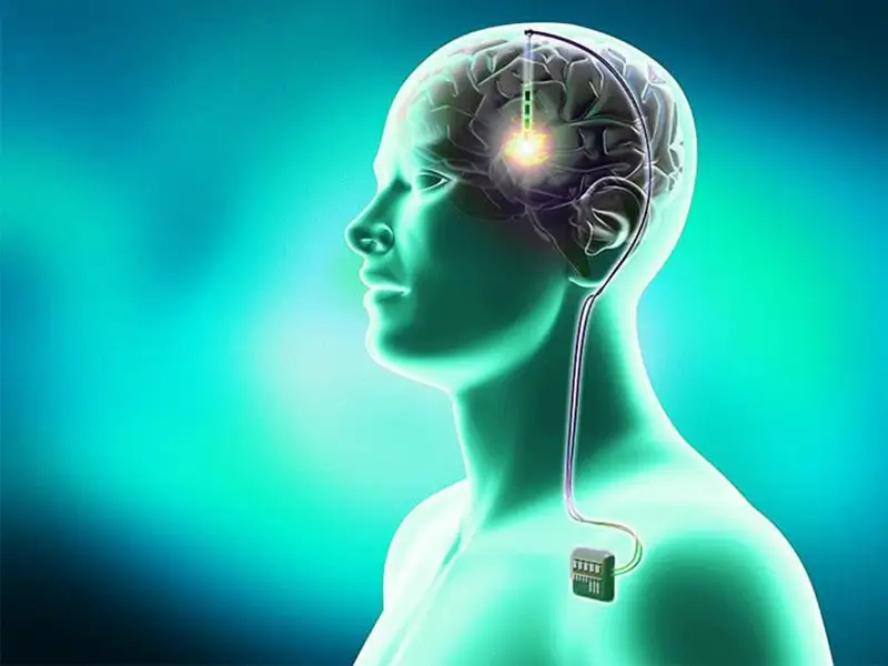Researchers develop brain stimulation device for Parkinson’s patients