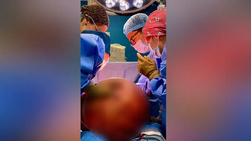 врачи операция хирурги