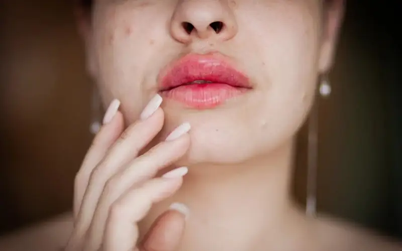 Павлодарлық қыз бет-әлпетін бүлдірген косметологтан 400 мың теңге өндіріп алды