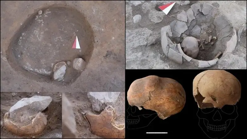 Archeologists discover 6,000-year-old skull in Turkish Mediterranean region