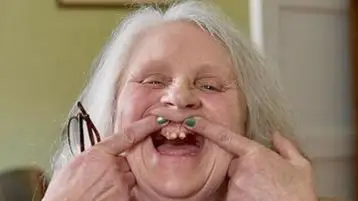 кризис в британской стоматологии 