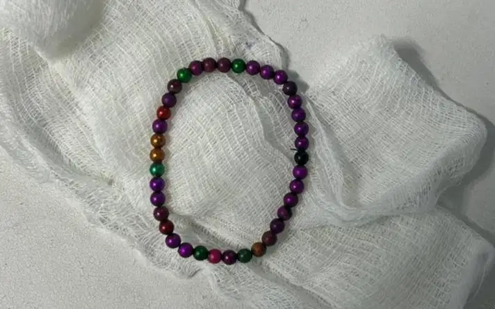 Ақмолалық хирургтар баланың ішегінен 39 бөгде затты алып шықты