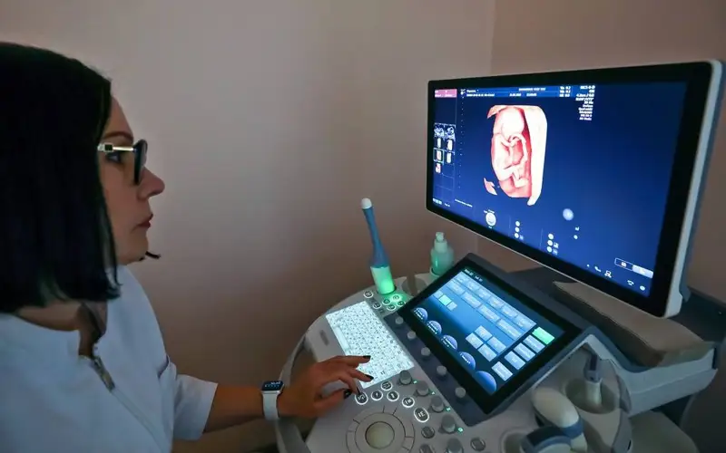 Найден способ предсказывать рождение маловесного ребенка при планировании